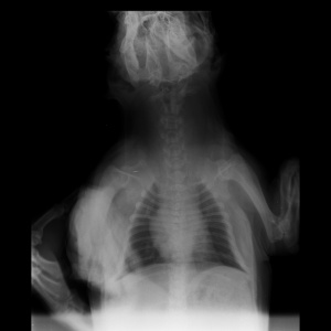Small Skeletal   10 kg Spine Cervical VD 28.02.2018 16 37 14 946