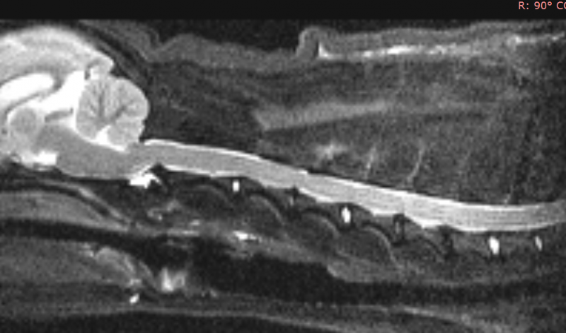 Мрт картина грыжи диска в шейном отделе позвоночника