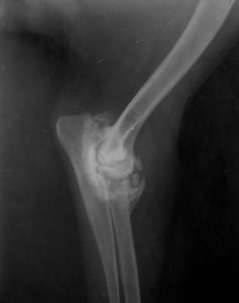 Рентгенологическая картина остеофитоза