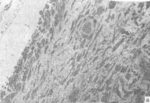 Клеточный состав зоны дефекта головки бедренной кости